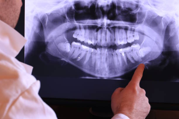 Best Emergency Gum Pain Relief  in Ansonia, OH